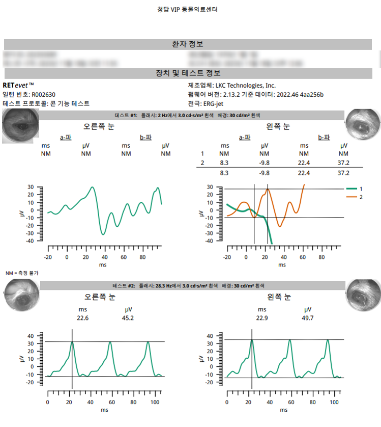 망막전위도 1.png