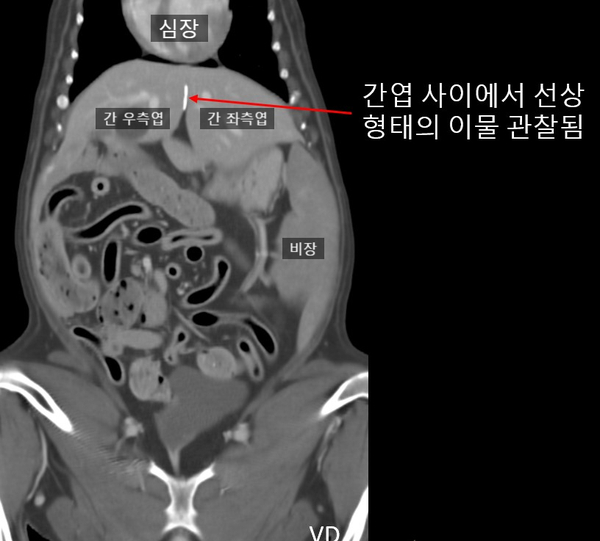 강아지 이물질 삼킴 14.jpg