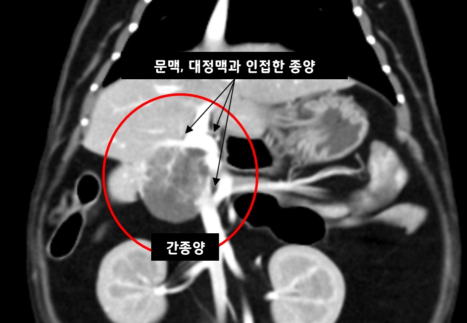 고양이 간종양 색전술 1.jpg