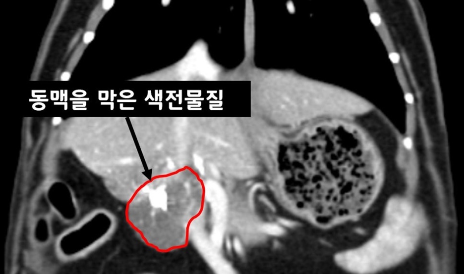 600고양이 색전술 시술 6주차 1.jpg