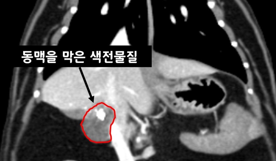 600고양이 색전술 시술 10주차.jpg