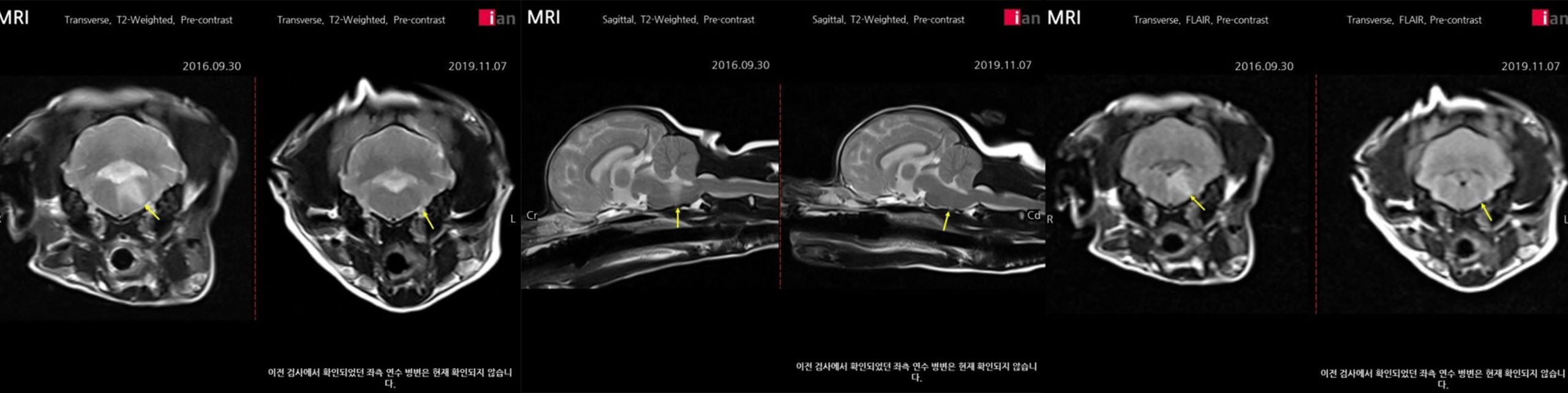 치료후04.jpg