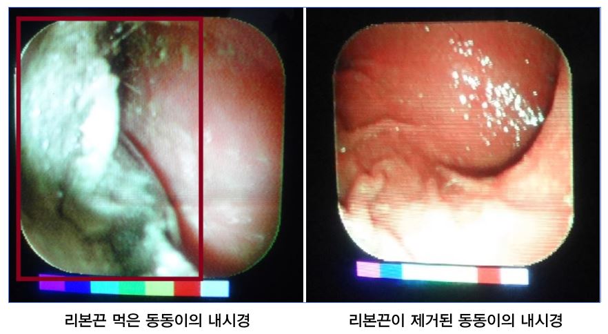 선형이물06.JPG