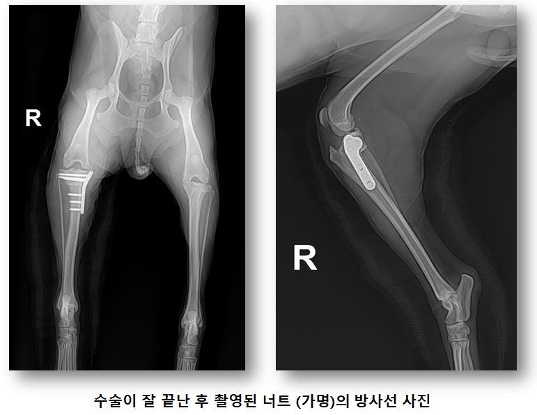 인대03.JPG