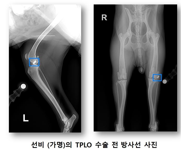 인대04.JPG