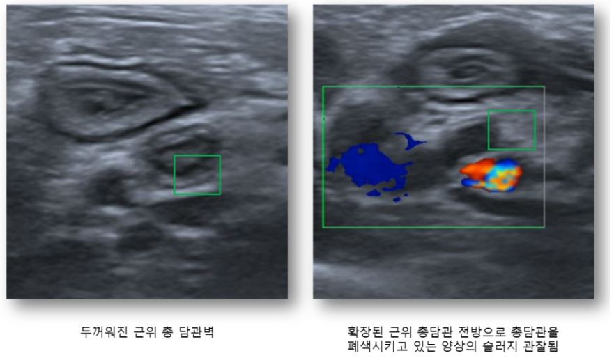 왕자07.JPG