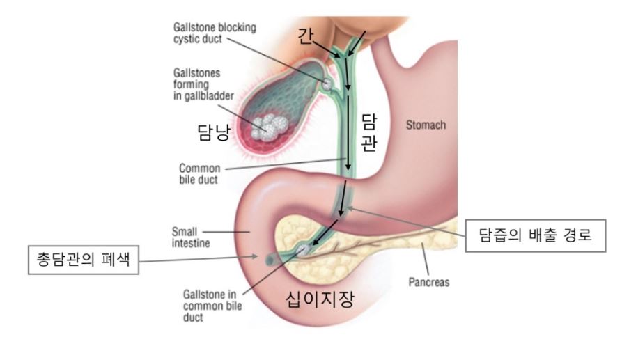 왕자10.JPG