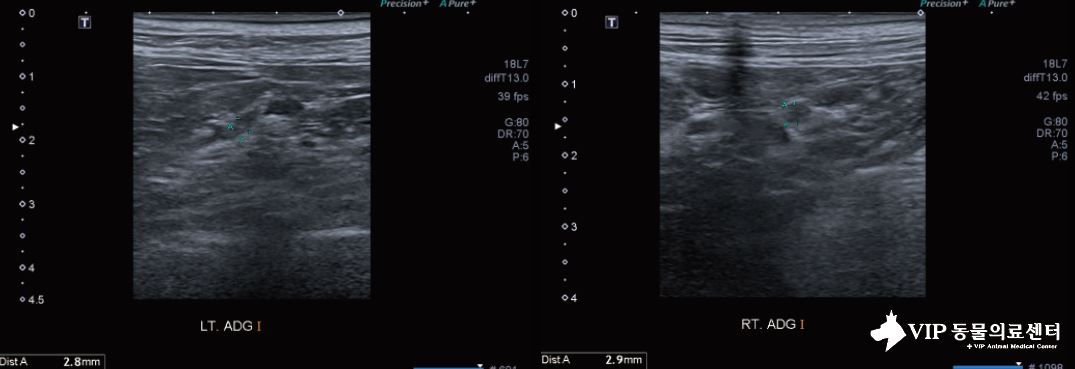 에디슨 수정03.JPG