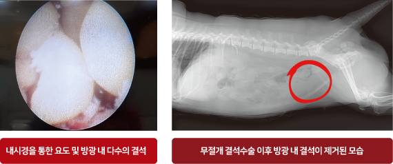 배뇨곤란 적용증례