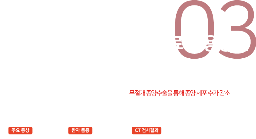 항암치료 적용증례